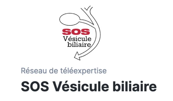 SOS Vésicule sur Omnidoc